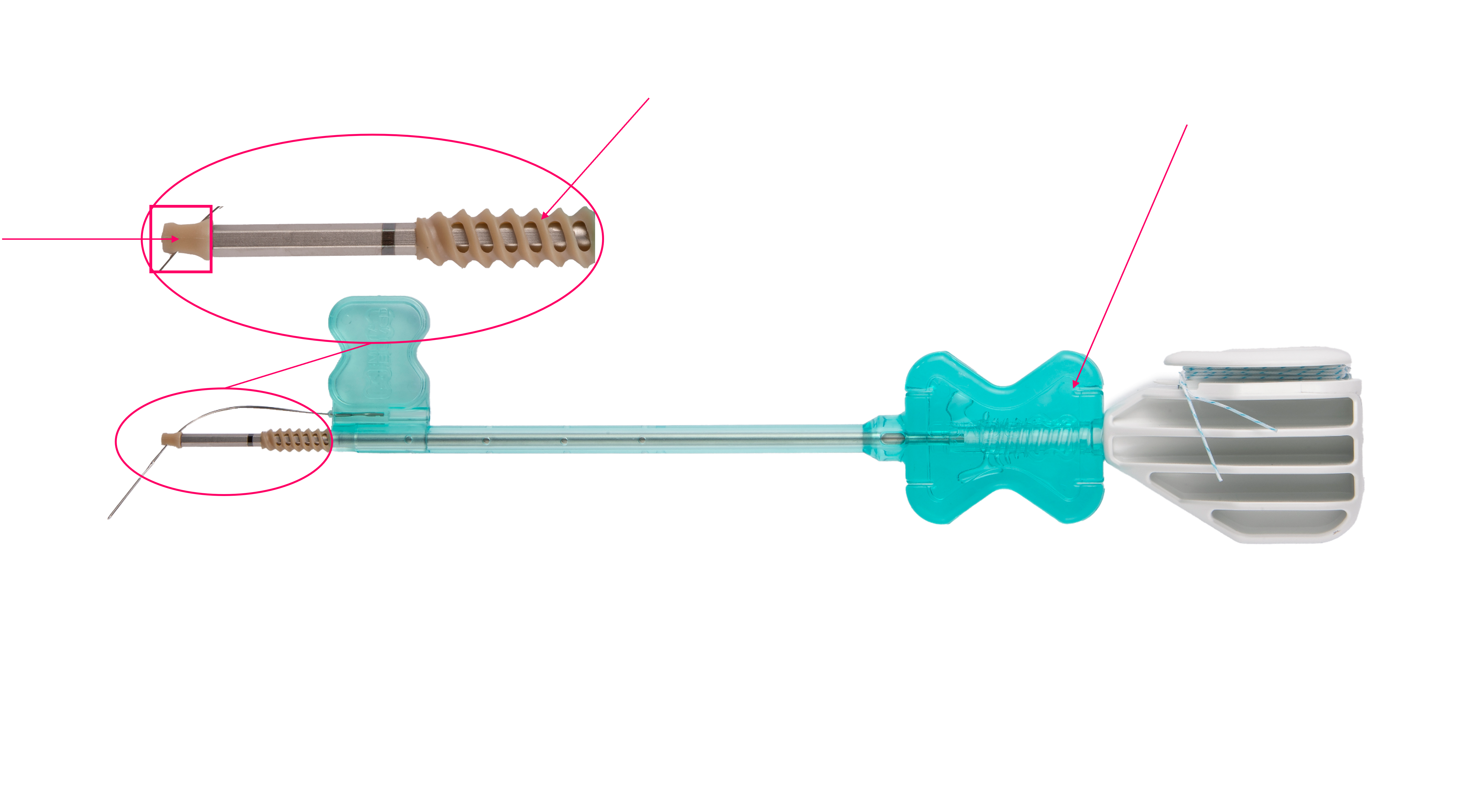 MetaLock Knotless > SURGICAL | META BIOMED